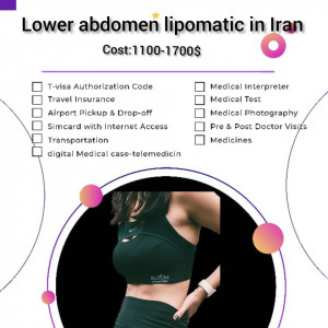 Upper abdomen lipomatic surgery in Iran