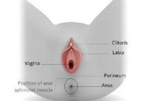 Perineoplasty in Iran(women's perineal injury treatment in Iran)